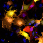 Transfected Cos-1 cells expressing the different color fluorescent proteins strawberry, orange and cherry. Nuclei are counterstained in blue.