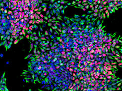 Fluorescence image of iPS cell-derived human stem cells.