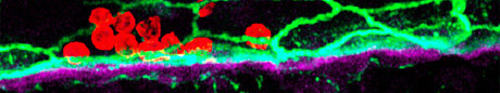 Gaining a better understanding of inflammatory diseases Gaining a better understanding of inflammatory diseases