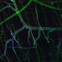 Eine Entzündungsreaktion wurde mit Histamin ausgelöst und die durchlässigen Zellkontakte mit Hilfe von kleinen blauen Kügelchen (Microspheres, 100 nm) sichtbar gemacht. Die Blutgefäße sind grün markiert.