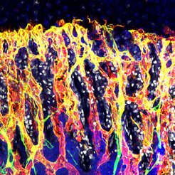 Angiogenesis and osteogenesis in the tibia of the mouse: endothelial cells are marked for CD31 (green) and endomucin (red). Yellow depicts an overlap of the green and red marks – these H-type capillaries are involved in bone formation. Bone-forming cells (white) specifically group along these H-type capillaries. Cell nuclei are marked in blue.