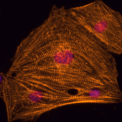 Aus humanen pluripotenten Stammzellen abgeleitete Herzmuskelzellen in der Petrischale (Immunfluoreszenzfärbung)