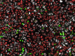 Germ cell development in a petridish:Gene products of the typical germ cell marker gene OCT4 (red), BLIMP1 (green) and BRACHYURY (white) were analyzed by fluorescence microscopy. About 5% of the cells in this culture are germ cell precursor cell that later on develop into germ cells.