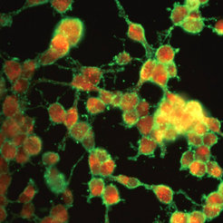 Oligodendrocyte precursor cells (iOPCs) can be kept in culture for over 31 passages. They display typical bipolar morphology and express two oligodendrocyte markers (red and green).