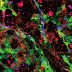 After transplantation into the spinal cord white matter, iOPCs (green) migrate to the place of contusion, differentiate into myelin-producing oligodendrocytes (red) and remyelinate the axons (blue) of neurons.