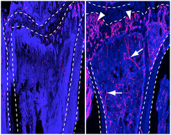 Certain capillaries, so-called CD31-positive capillaries (red, arrowheads), and arteries (arrows) are formed after Notch activation in endothelial cells in ageing mice (right). They are missing, however, in control animals of the same age (left). Lines mark the outlines of the bones in cross-section, with cell nuclei coloured blue.