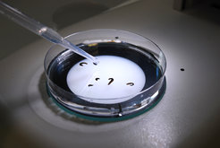 Mit einer Plastikpipette werden Plattwürmer in einer Petrischale platziert, um unter dem Binokular betrachtet zu werden.
