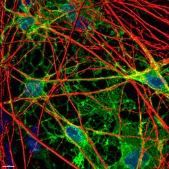 Humane Oligodendrozyten, die Myelin (grün) um aus iPS-abgeleiteten Neurone (rot) bilden. Zellkerne sind blau markiert.