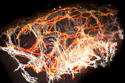 Digitale 3D-Rekonstruktion einer gesunden menschlichen Hautbiopsie. Man erkennt deutlich die räumliche Anordnung der Blutgefäße (weiß) und Lymphgefäße (rot).