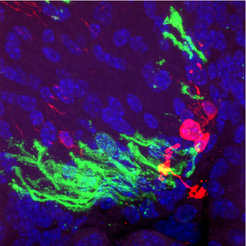 In vivo myelination after transplantation of pre-differentiated pre-oligodendrocytes (green: myelin basic protein, MBP; red: cells derived from iOPCs, blue: nuclei).