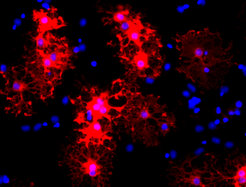 Reife Oligodendrozyten (roter Marker: Myelin-Basisches Protein) in einer in vitro Kultur. Sie differenzierten sich aus induzierten Oligodendrozyten-Vorläuferzellen (iOPC), die wiederum aus Perizyten entstanden sind (blau: Zellkerne).