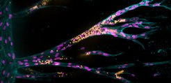 Scientists have succeeded in designing a synthetic hydrogel in which endothelial cells (pink cell nuclei) form new blood vessels that grow from a parent blood vessel (upright on the left). Here, the vessels were perfused with a liquid containing fluorescent beads (yellow). Using fluorescence microscopy the scientists showed that the beads flowed into the new vessels at a natural speed and that these actually formed cavities connected to the parent vessel.
