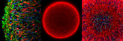 Links: Äußere Region eines Organoids (blau: Zellkerne; rot: Dopamin-produzierende Neurone; grün: neurale Vorläuferzellen).Mitte: gesamtes Organoid (rot: Marker für junge Neurone).Rechts: Zentrum des Organoids (blau: Zellkerne; rot: junge Neurone; grün: Marker für neuronale Stammzellen)