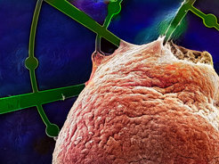 Ein menschliches Hirnorganoid (rötlich eingefärbt) wächst auf der hängemattenartigen Netzstruktur eines Mesh-MEAs (grün eingefärbt). Die rasterelektronenmikroskopische Aufnahme zeigt, wie das Hirnorganoid die Netzfilamente und Mikroelektroden (runde Strukturen im grünen Mesh-MEA) umwachsen hat. Die meisten der 61 Mikroelektroden sind in der Masse des Hirnorganoids verborgen. Dieses humane Hirnorganoid wuchs ein Jahr lang auf dem Mesh-MEA.