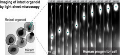 We use live imaging of in vivo systems and organoids to explore how cells work together to ensure the development of healthy organs. Time is shown in hh:mm.