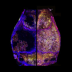 Lebenslanges Gefäßwachstum und Knochenmarkexpansion des Schädels. Schädelknochenmarkgefäße einer jungen erwachsenen (li.) und geriatrischen (re.) Maus., mit Immunfluoreszenz dargestellt: Rot: CD31, Grün: Endomucin, Blau: DAPI.